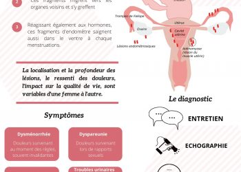 Endométriose : le test salivaire Endotest créé à Lyon révolutionne le diagnostic de la maladie – France 3 Régions Endométriose : le test salivaire Endotest créé à Lyon révolutionne le diagnostic de la maladie – France 3 Régions