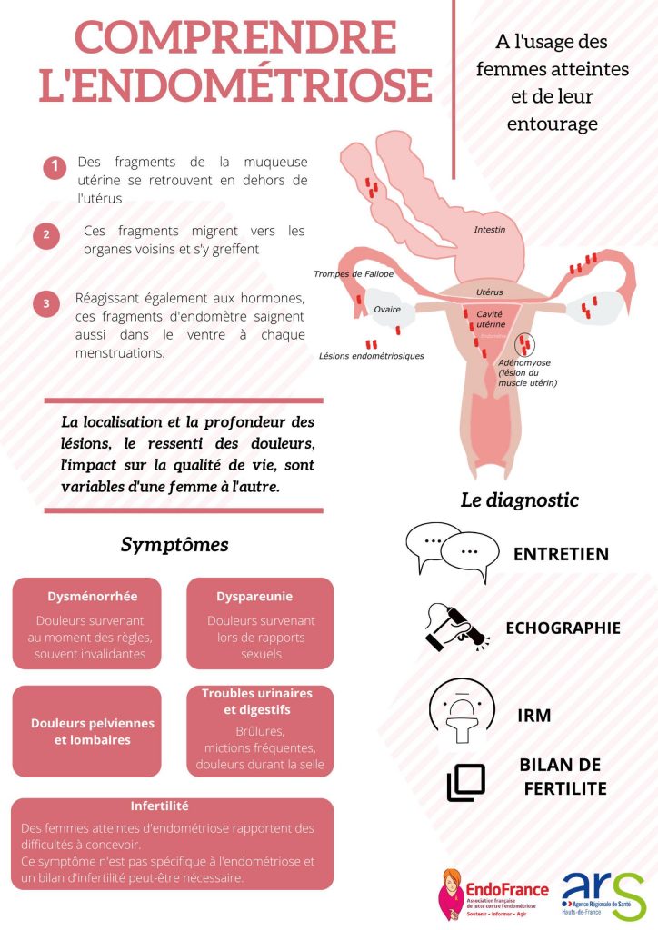 Endométriose : le test salivaire Endotest créé à Lyon révolutionne le diagnostic de la maladie – France 3 Régions