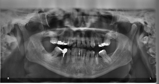 Recommandations pour une meilleure transmission des données radiographiques