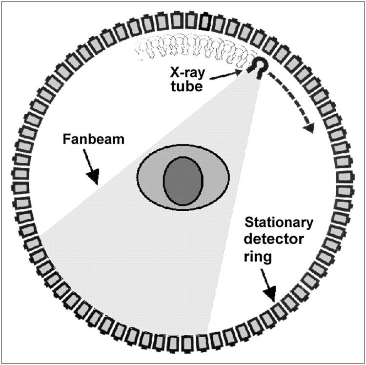How Continental France Transformed Operations with Cutting-Edge CT Technology