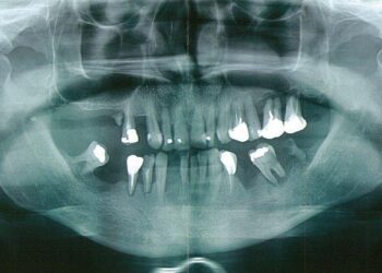 Dental Mutilations in Marseille: Lionel and Jean-Claude Guedj Sentenced for Good