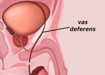 Un homme arrêté à Nice pour avoir escroqué 5 millions d’euros à Dany Boon en se faisant passer pour un lord irlandais